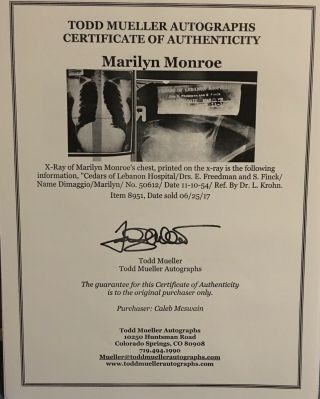 Very Rare Xray X - Ray Of Marilyn Monroe’s Chest With
