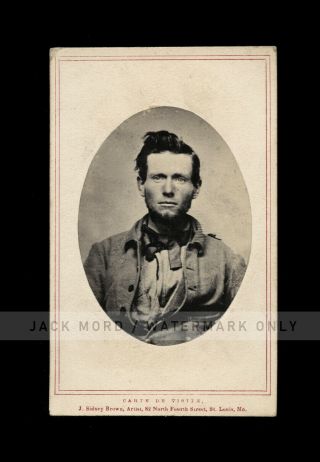 1860s Cdv Photo Of A Saint Louis Missouri Man Confederate Civil War Soldier ? ??