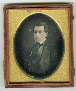 1/4 Plate Daguerreotype Of Distinguished Man With Rosy Cheeks In Detached Case