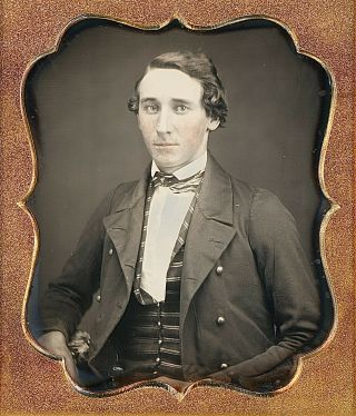 Young Man With Freckles Wearing Striped Waistcoat 1/6 Plate Daguerreotype G252
