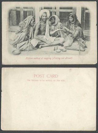 India Old Ub Postcard Native Method Of Cupping Taking Out Blood,  Hindu Women Man