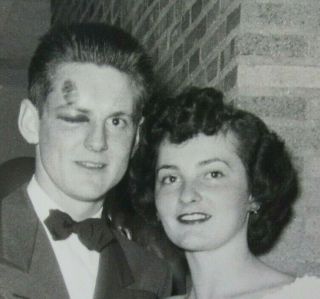 Date Night With A Black Eye Shiner Prom Or Formal Photograph 1940s