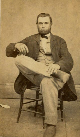Civil War Era Antique Cdv Photo Man With Beard Fashion