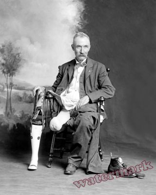 Photograph Civil War Amputee James Hanger & His Artificial Leg 1902 Circa 8x10
