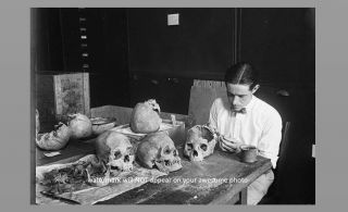 Creepy Vintage Autopsy Photo Scary Weird Skulls Strange Spooky Skeleton Science