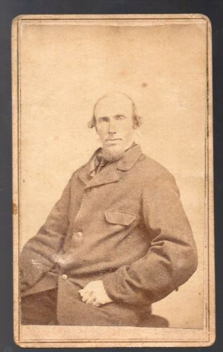 Civil War Era Cdv Photo Of Balding Man In Soldiers Wool Paletot Style Frock Coat