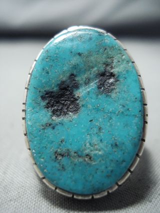Incredible Vintage Navajo Kingman Turquoise Sterling Silver Ring