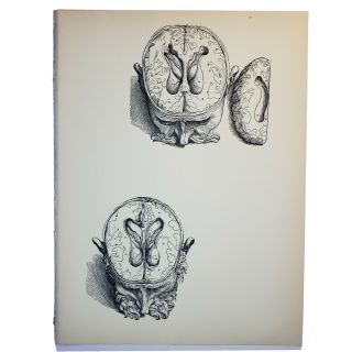 1950 Vintage Andreas Vesalius Print - Further Dissection Of The Brain (4)