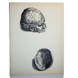 1950 Vintage Andreas Vesalius Print - Dissection Of The Cranium - Anatomy
