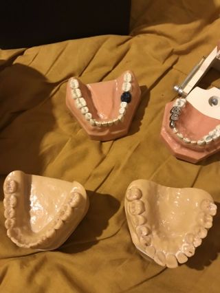 Kilgore International Human Skull Vintage Dental Oddity Dental Teeth 4