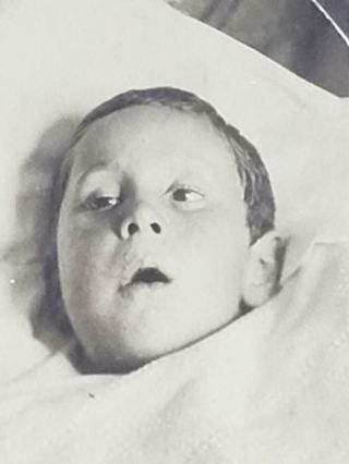 Rare Antique Cabinet Photo Post Mortem Dead Young Boy Dilated Eyes Open & Mouth